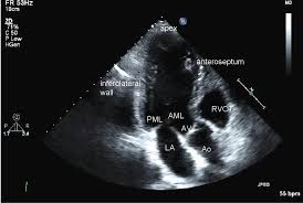 Echocardiogram byCardiologist in Houston
