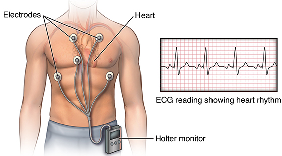 Cardiologist in Houston | Dr. Zacca Treats Heart Patients